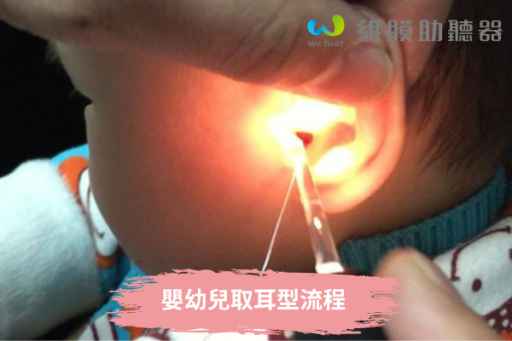 嬰幼兒取耳型流程